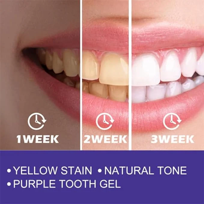 Purple Whitening Toothpaste - Image 3